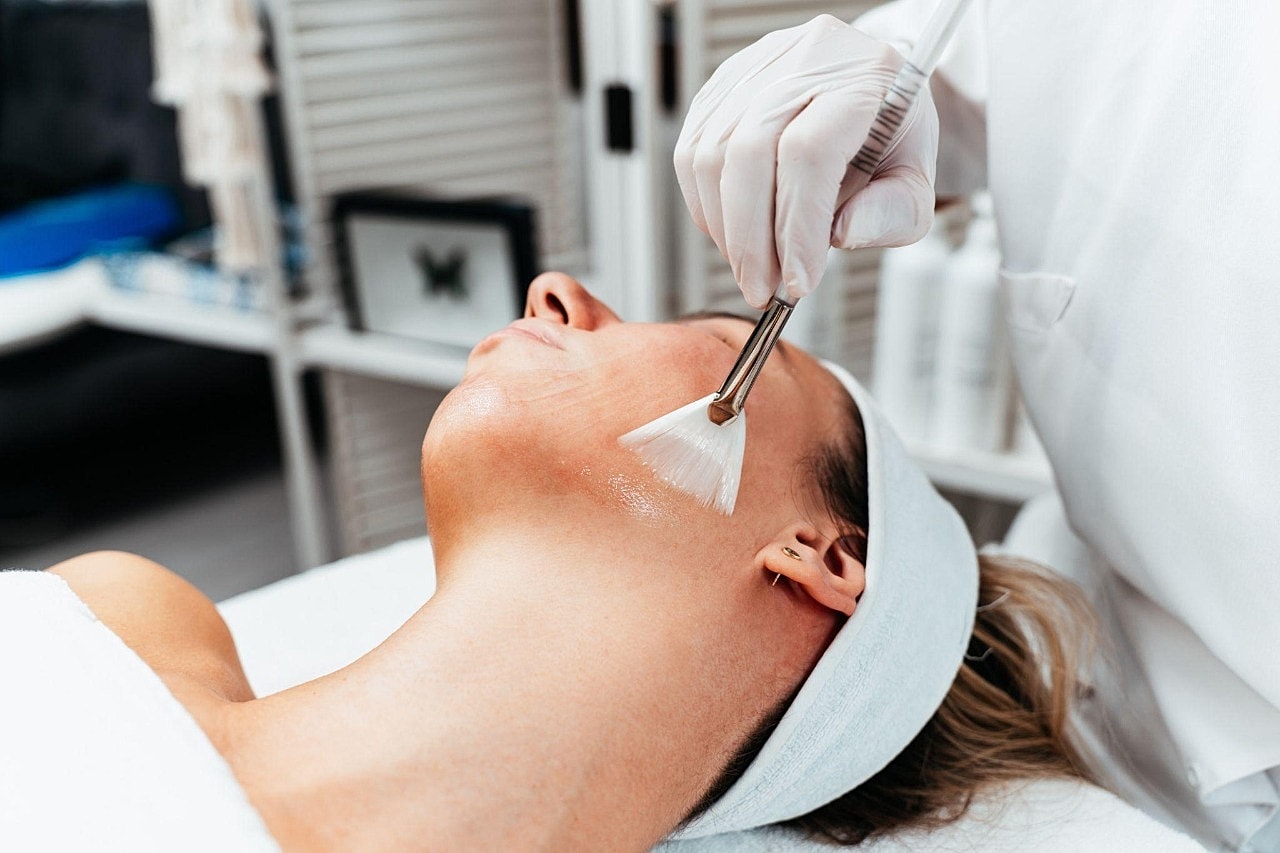 Chemical Peel For Acne Scars And Dark Marks