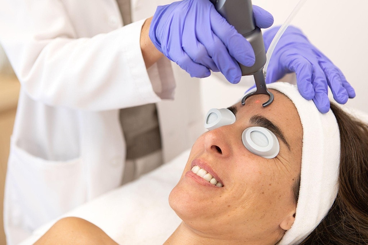 Laser Skin Rejuvenation For Acne Scars