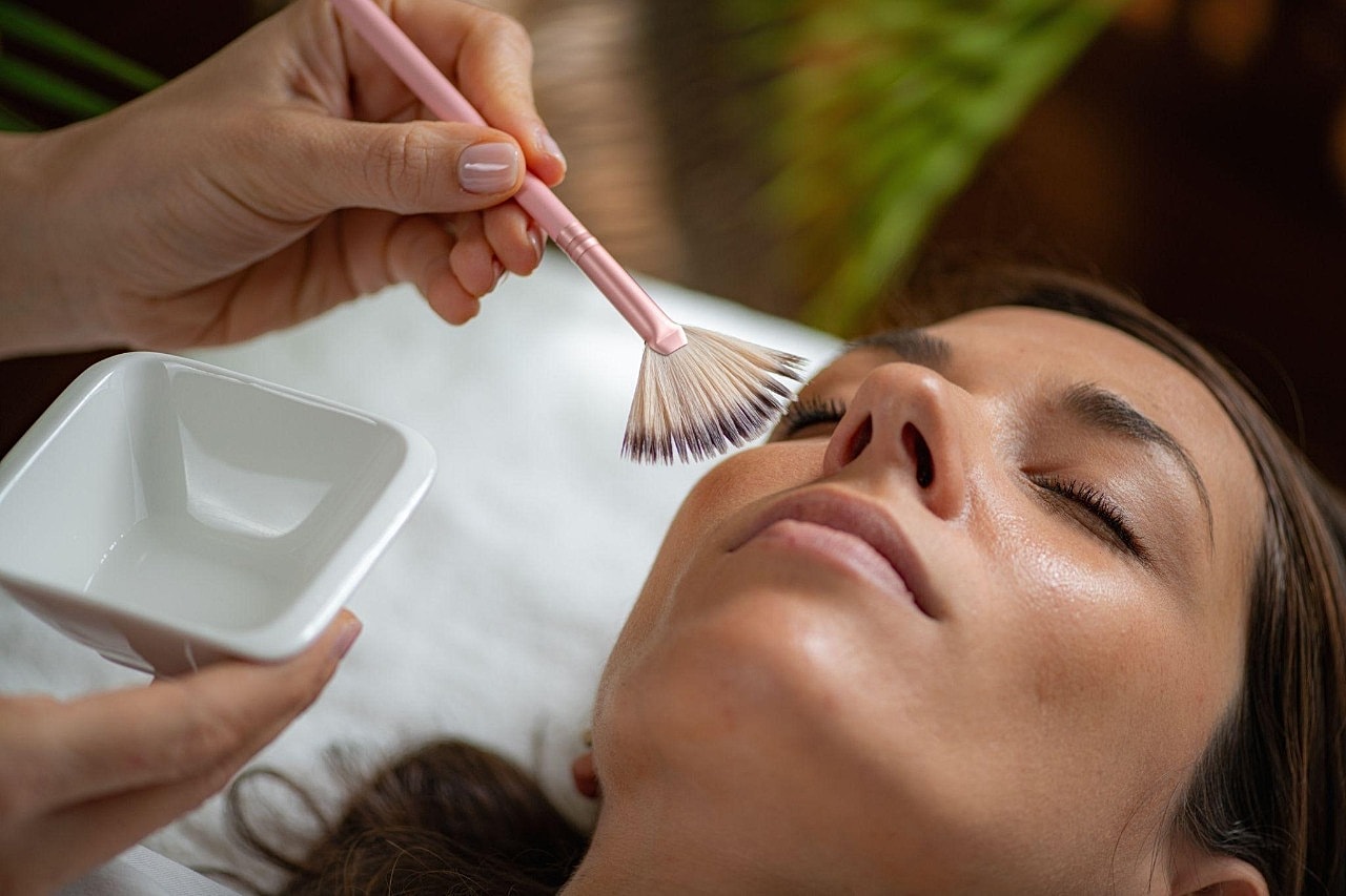 VI Peel For Acne Scarring