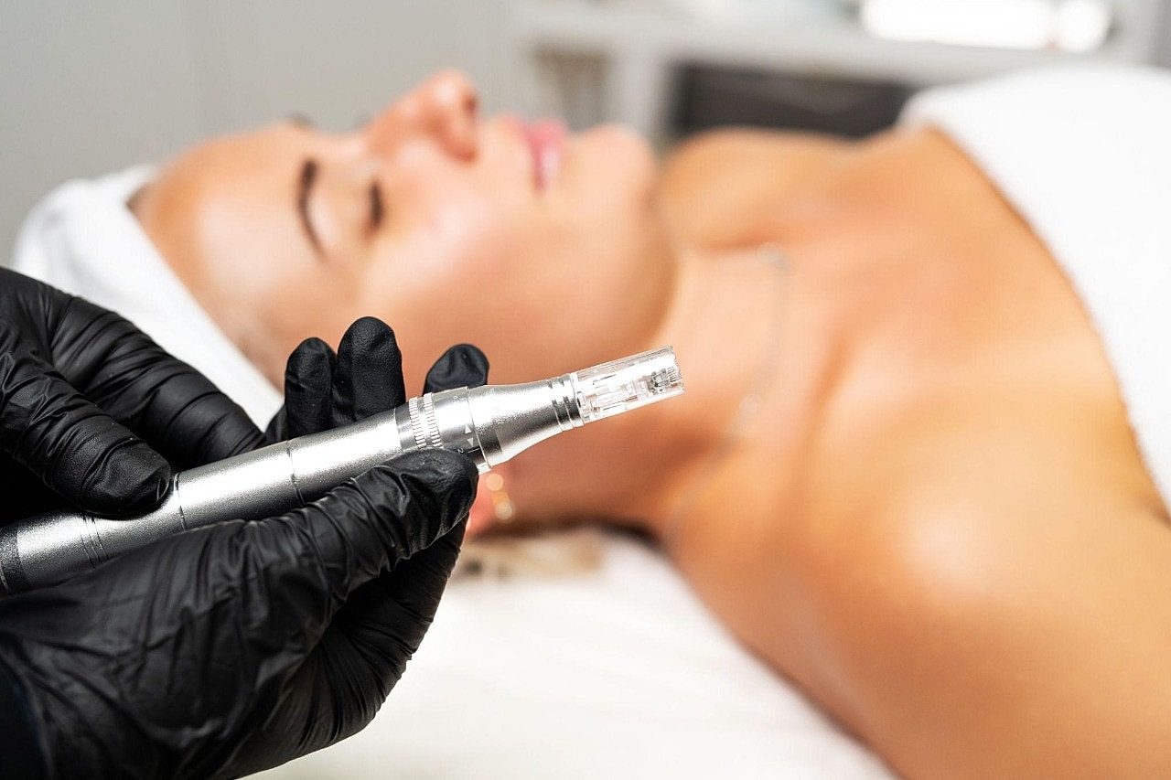 What Is Microneedling for the Face?