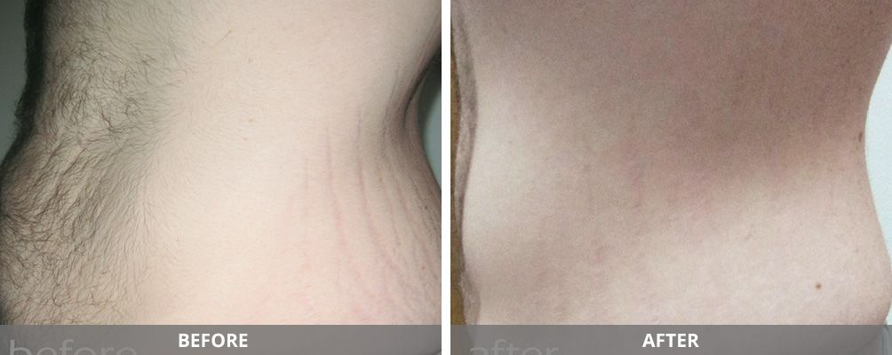 Facial And Body Contouring Before & After