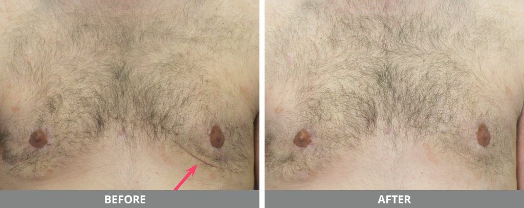 Viora Reaction Before & After