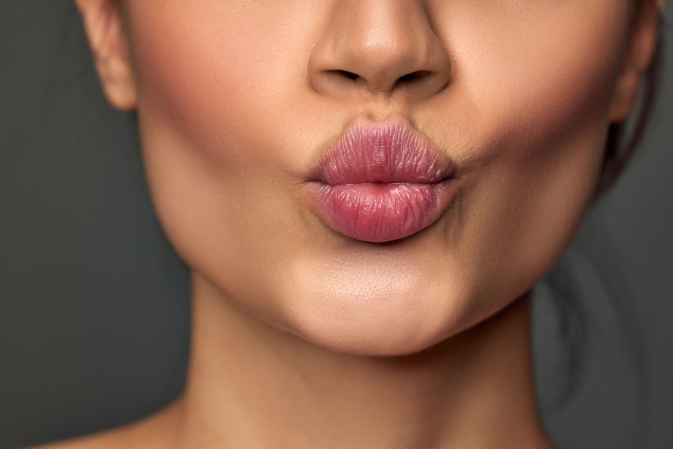 juvederm patient model puckering her lips