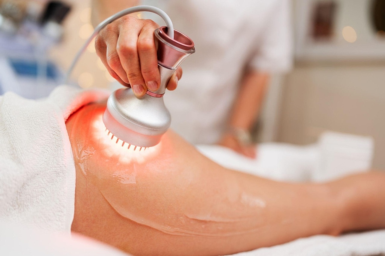 Why We Are a Trusted Choice for Cellulite Reduction in Bellevue