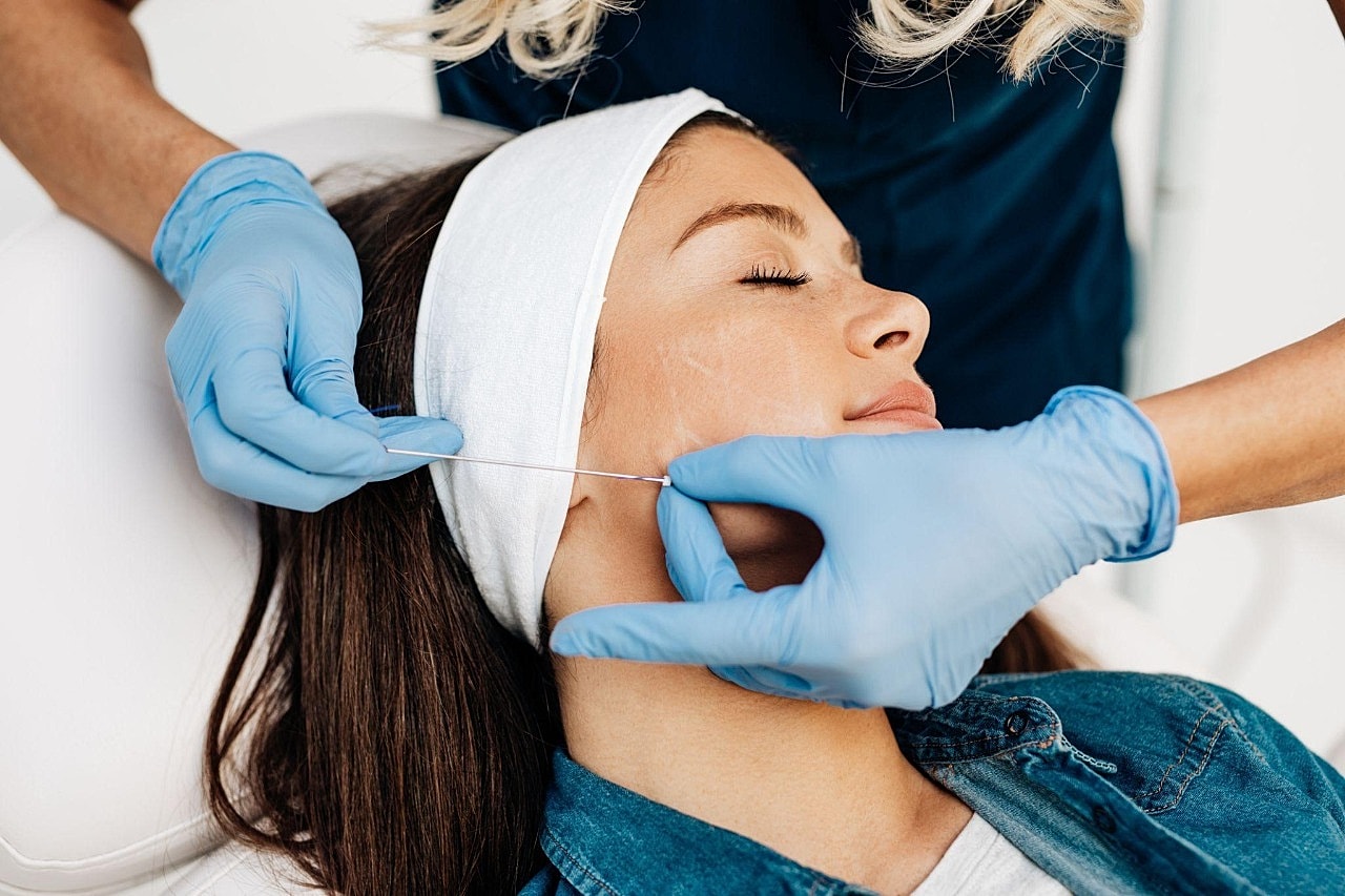 Why We Love PDO Thread Lift for Non-Surgical Rejuvenation