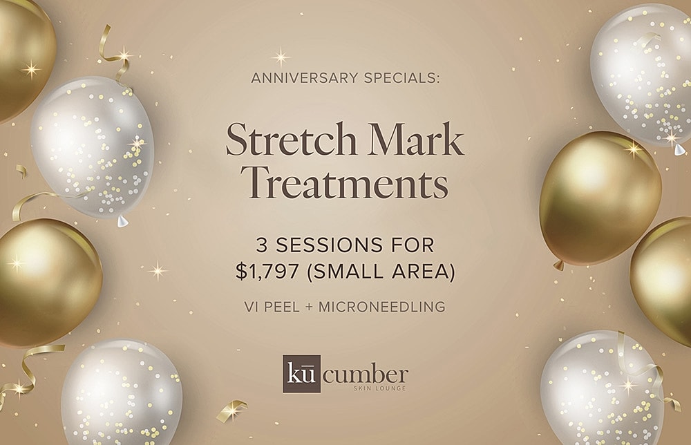 Anniversary special for stretch mark treatments offer.
