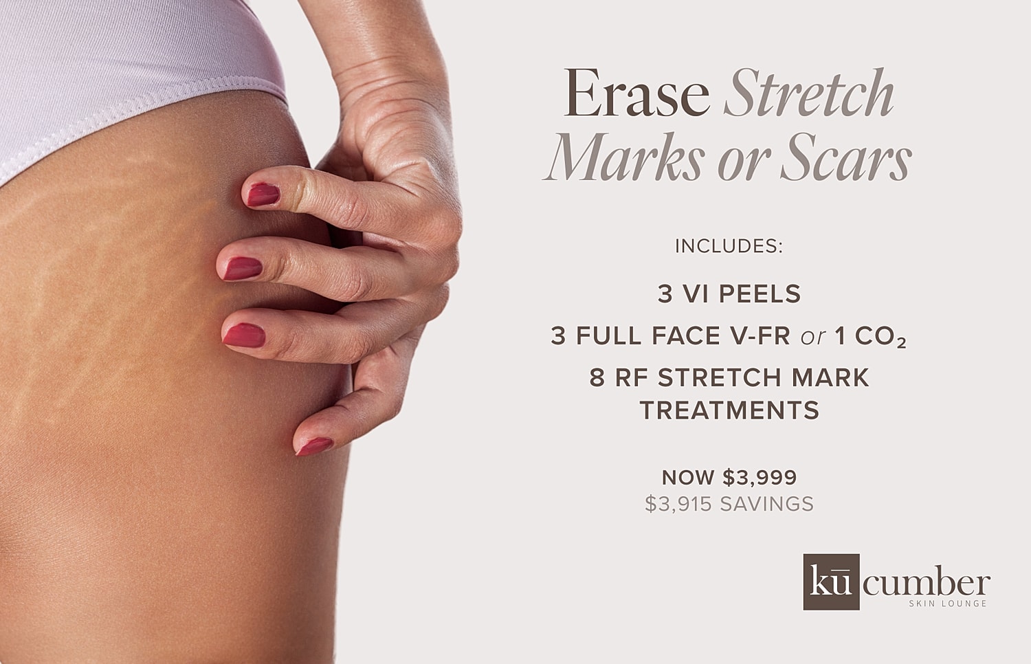 Stretch mark treatment promotional offer with details.